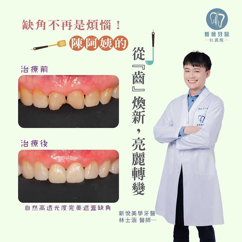 新悅美學牙醫診所的案例分享圖片